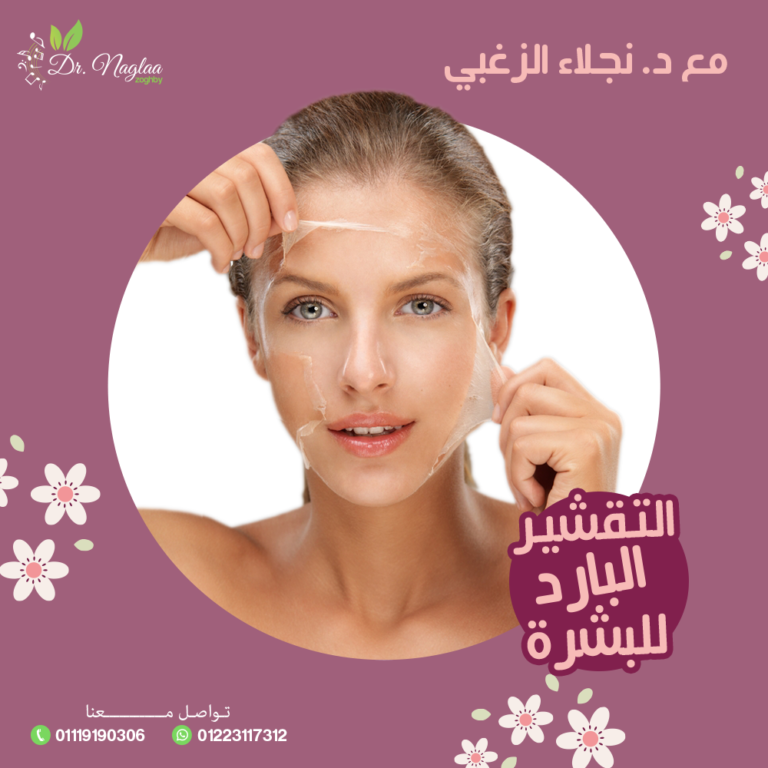 التقشير البارد للبشرة