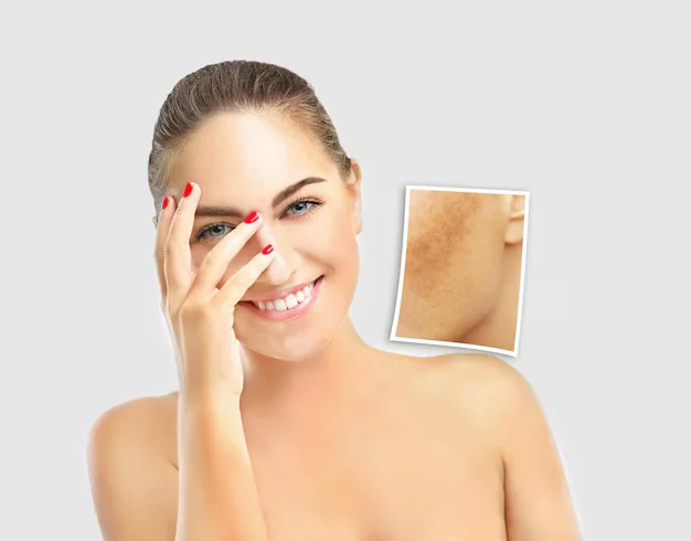 اسرع علاج للكلف لإزالة التصبغات واستعادة نضارة البشرة