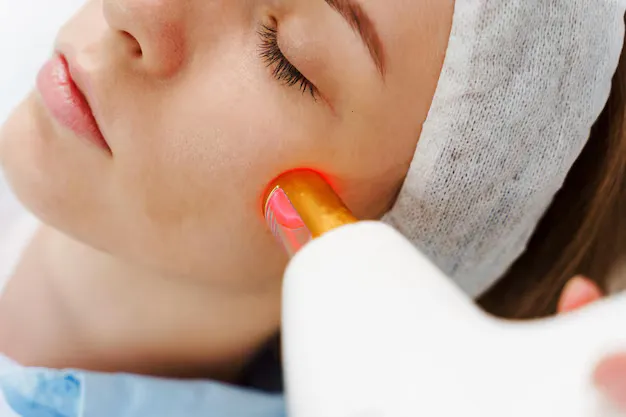 تفتيح البشرة بالليزر في مركز لاروز