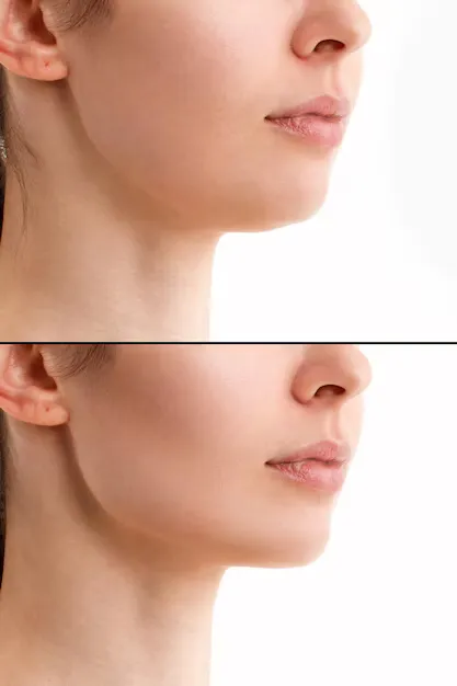 صور توضح نتائج فيلر الذقن قبل وبعد بطريقة آمنة وفعالة