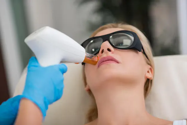 ازالة شعر الشنب بالليزر في مركز لاروز مع د/ نجلاء لتحقيق نتائج دقيقة وفعالة