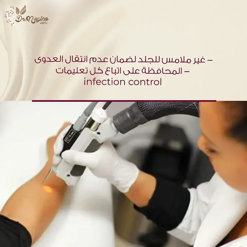 جلسة ازالة الشعر بالليزر باستخدام جهاز سيناشور